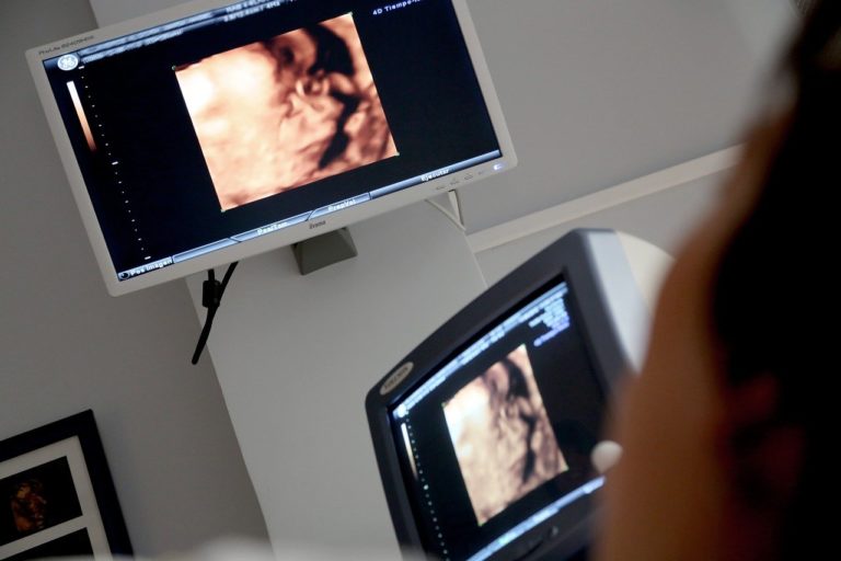 Jednym z nierzadko robionych badań diagnostyki obrazowej jest USG